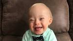  As terminations rise, will Gerber's Down syndrome 'spokesbaby' change attitudes?