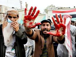 Image result for WAR IN YEMEN PHOTO