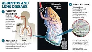  Best Mesothelioma Lawyers - A Saving Elegance for Mesothelioma Victims 