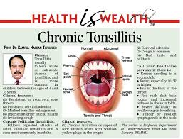 Image result for tonsillitis