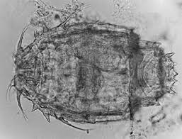 Bdelloid rotifers, by Aydin Örstan – Quekett Microscopical Club