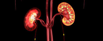 Pig kidneys A Medical Milestone: Human Lives Saved with Pig Kidney Transplants