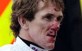 Tony McCoy plans to ride at Ascot despite being kicked in the face at Wetherby. Battered: Tony McCoy heads for York hospital after his accident Photo: PA - tony_Mccoy_2387364b