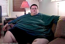 Image result for obese