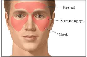 Image result for images of sinus