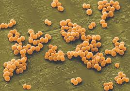 Image result for Staphylococcus aureus