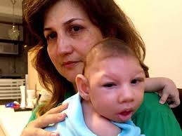 Image result for image of zika baby
