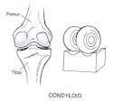 condyloid