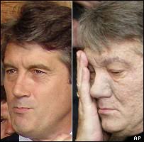 Viktor Yushchenko in July (left) and November 2004. Mr Yushchenko says poison caused a sudden change in his appearance - _40565531_yushchenko_203