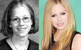 Resultado de imagem para antes e depois dos famosos