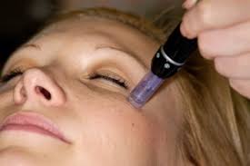 Medial Microdermabrasion Treatment