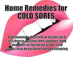 Home Remedies for Cold Sores - Controlling the Herpes Virus Lip ... via Relatably.com