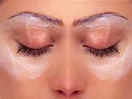 Image result for Amazing Home Remedy For Treating Eye Bags