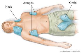 Image result for hypothermia treatment