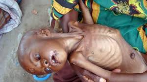 Resultado de imagen para niños muriendo de hambre