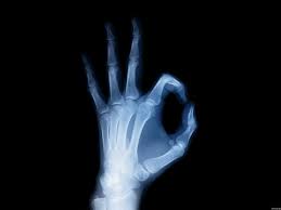 Znalezione obrazy dla zapytania rentgen