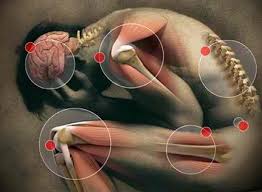 Image result for bone pain images