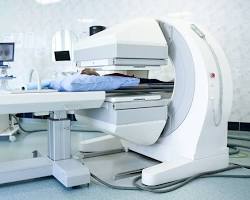 Image of nuclear medicine scan