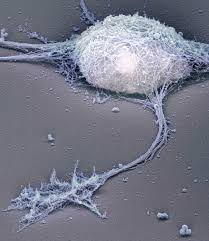 Image result for axon neuron electron          microscopy
