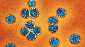 El peligro del nuevo coronavirus es el contagio entre personas Images?q=tbn:ANd9GcR5gKE2XXp5fivptdQPMjw52mrYoIQ-FD0ulrAGaS-0i_FKpeoB