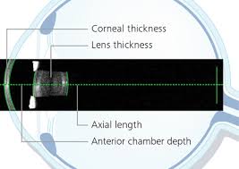 Image result for iol master