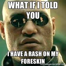 What if I told you I have a rash on my foreskin - What If I Told ... via Relatably.com