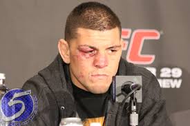 When Nick Diaz (Pictured) was slated to challenge reigning UFC welterweight king Georges St-Pierre for his crown last year, he was pegged as a 3-to-1 ... - UFCNickDiaz2