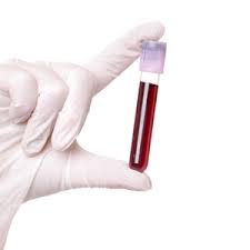 Image result for celiac blood test