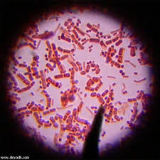 كل شيء عن البكتيريا Images?q=tbn:ANd9GcRpFn-xpWpFYj0gGWlItb-eXqGsDm2PgBD2HRTL7WoAVEigNTBtEQ