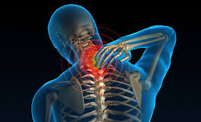 Image result for neck pain