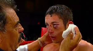 By Dan Ambrose: #5 WBA, #7 WBC, #7 WBO Mauricio Herrera (20-4, 7 KO&#39;s) is still bothered by his controversial 12 round majority decision loss to WBA/WBC ... - herrera667