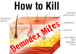 Image result for demodex