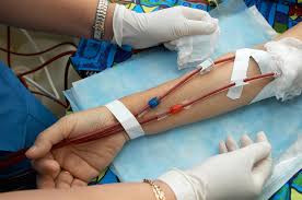 Image result for dialysis