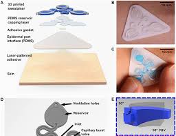 Revolutionizing Sweat Analysis with Spatially Engineered Microfluidic Systems for Skin Interface