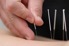  Acupressure & Acupuncture