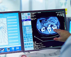 Image of medical imaging scan