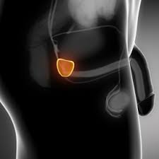Image result for How to prevent prostate problems