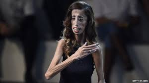 Image result for most ugliest girl lizzie