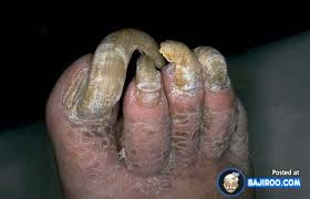 weird_bad_ugly_scary_strange_feet_foot_people_fingers_images_photos_pictures_2.jpg via Relatably.com
