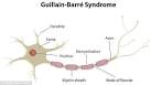 Syndrome de Guillain-Barr - Causes, Symptmes, Diagnostic