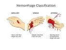 hemorrhage