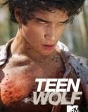 Scott, bir <b>kurt adam</b> olduğunu, yaşamı Teen Wolf izle ve vücudundaki <b>...</b> - teenwolf1-e1364311611769-125x160
