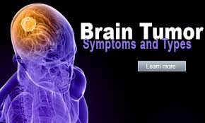 Signs of Brain Tumors Disorders