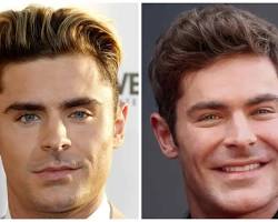 Imagen de Zac Efron before and after plastic surgery