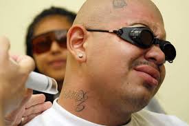 ... a $1.3-million contract, providing critically needed funding for the gang intervention program founded two decades ago by Father Gregory Boyle. - tattoo_removal