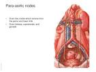 para-aortic bodies