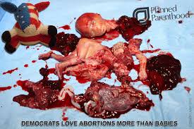 Image result for baby killed plan parenthood