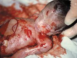 Image result for aborted baby parts pictures