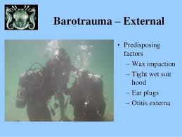 Image result for barotrauma ear