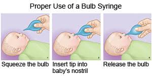 نتيجة بحث الصور عن ‪HOW TO CLEAN BABY NOSE STEPS‬‏